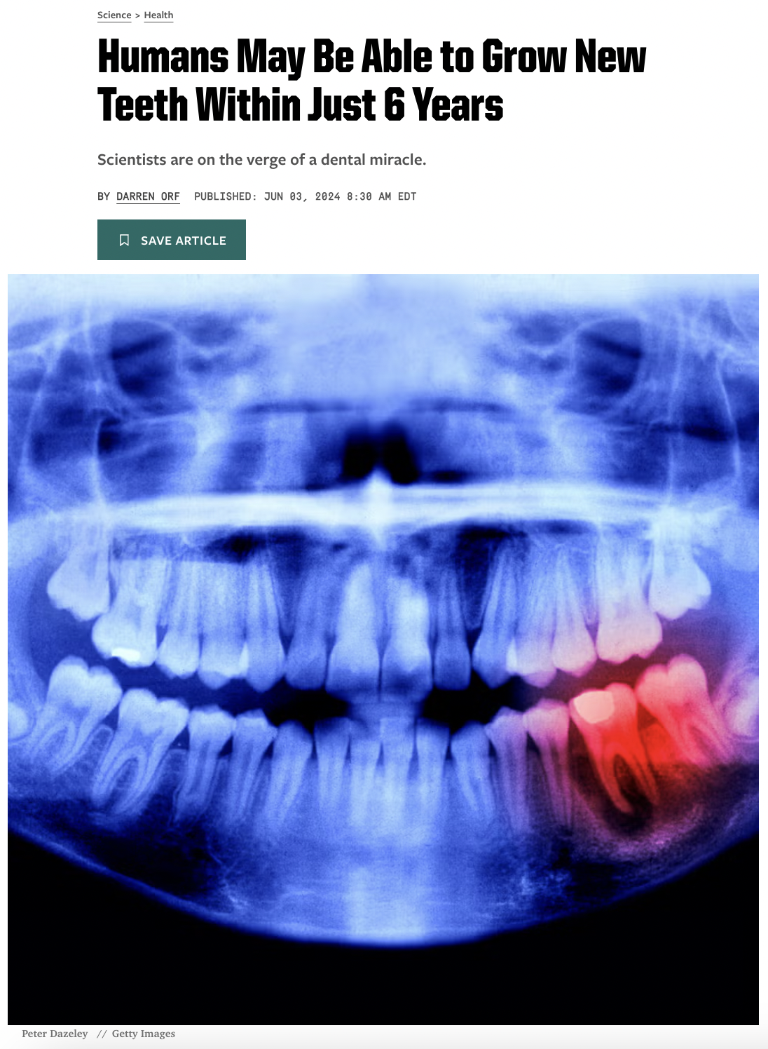 Humans May Be Able to Grow New Teeth Within Just 6 Years Scientists are on the verge of a dental miracle. By Darren De Published Jun 83, Est Save Article